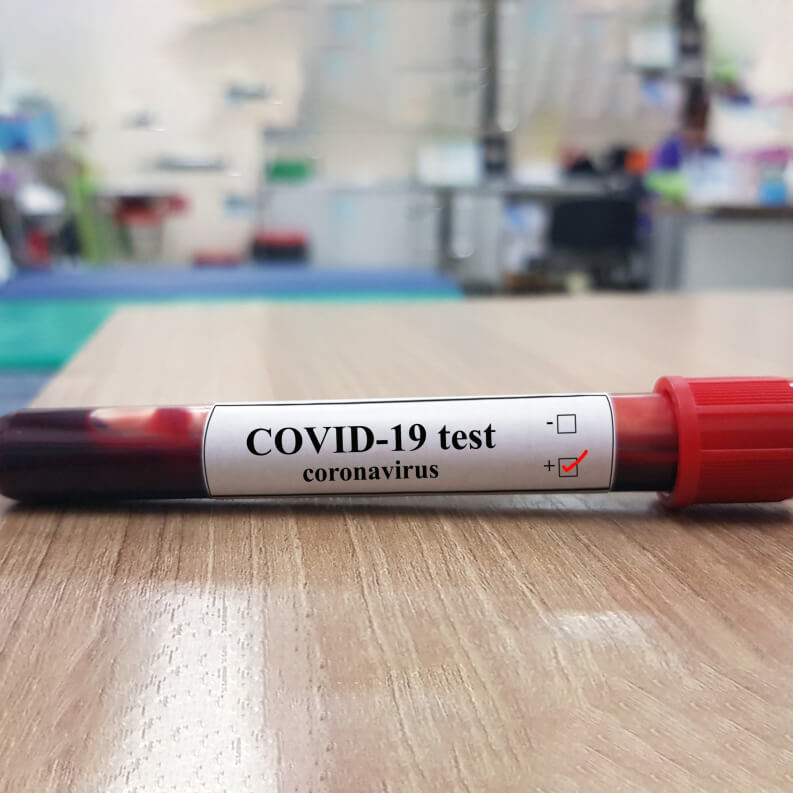 COVID - 19 Update